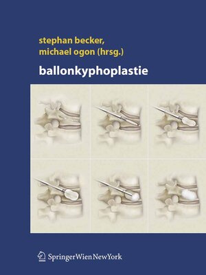 cover image of Ballonkyphoplastie